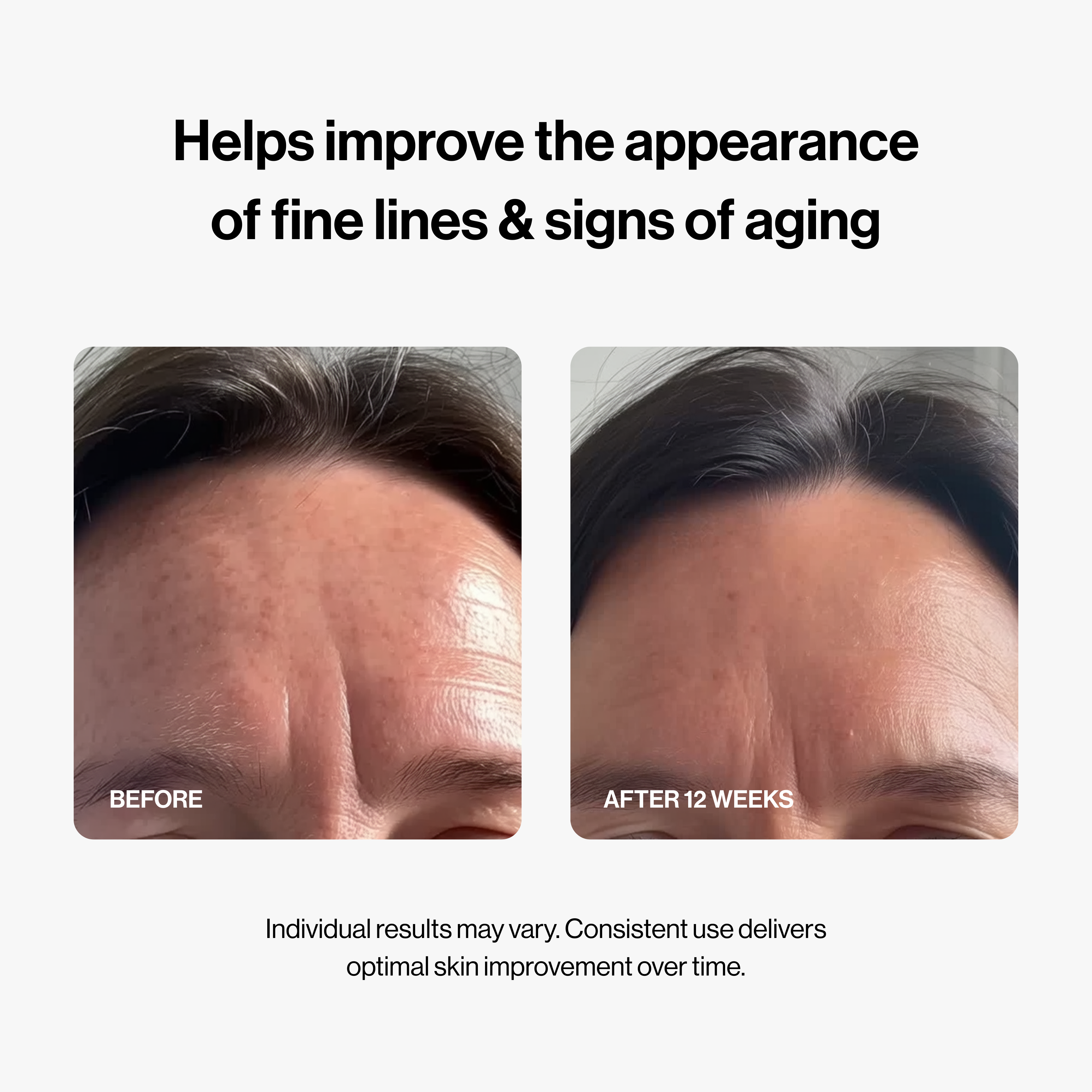 PDRN Micro-Infusion System